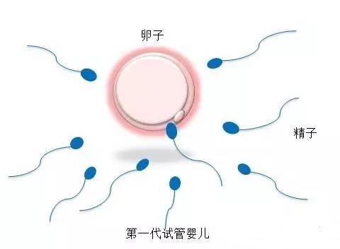 关于爱心供卵代怀助孕咨询哪家好